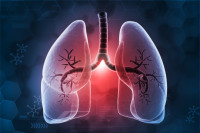 Johnson & Johnson desarrolla terapia contra el cáncer de pulmón sin quimioterapia