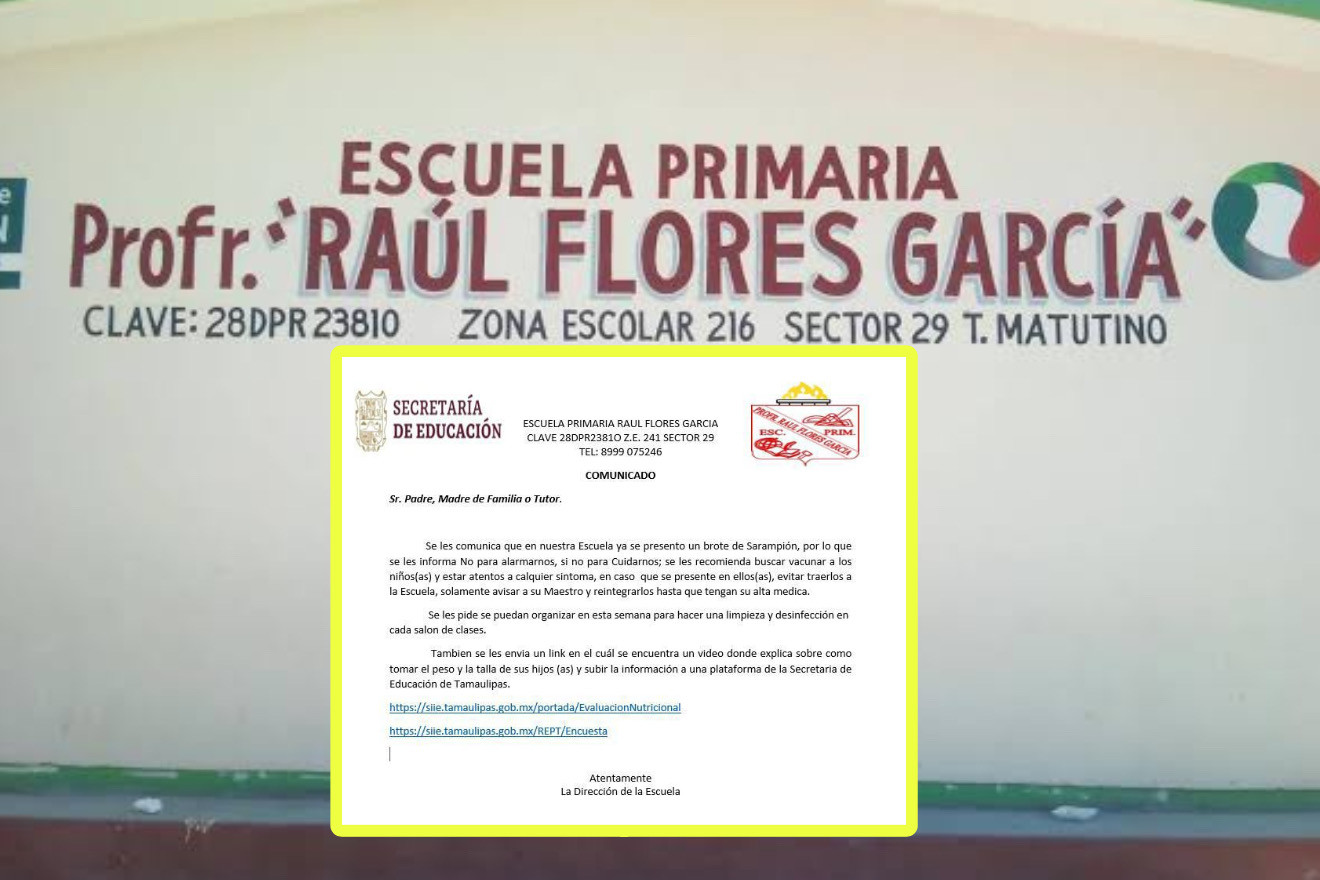 Detectan primer brote de sarampión en primaria de Reynosa