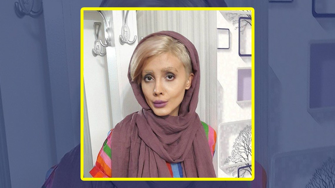 Mujer quería parecerse a Angelina Jolie pero ¡queda irreconocible!