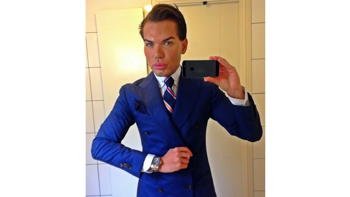 El "Ken humano" tiene complicaciones para respirar