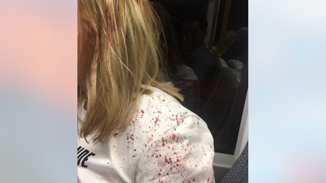 Al menos 20 muertos por explosión en concierto de Ariana Grande