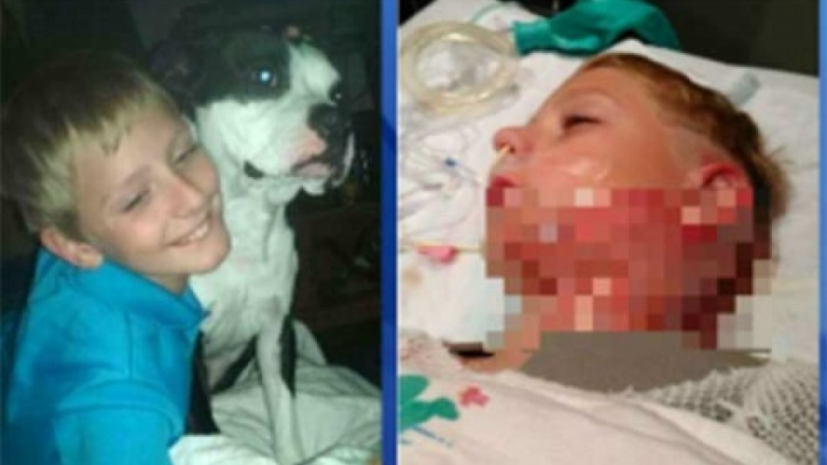 Padres preocupados por el nuevo ‘Hot Water Challenge’