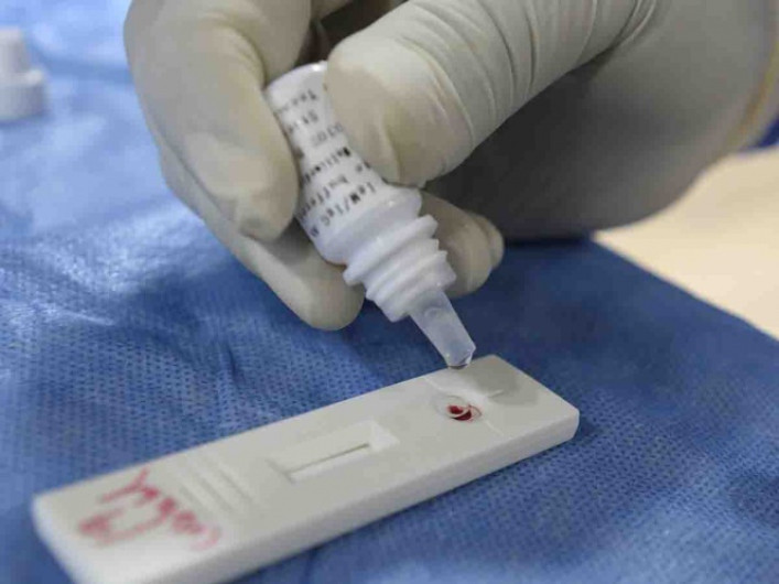 Perú trabaja en prueba para detección de COVID-19