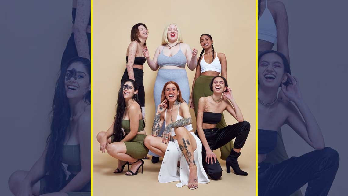 Así celebramos los "defectos" en la piel