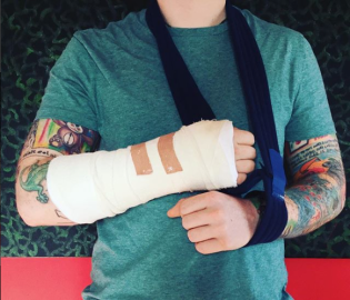 Ed Sheeran sufre accidente en su bicicleta