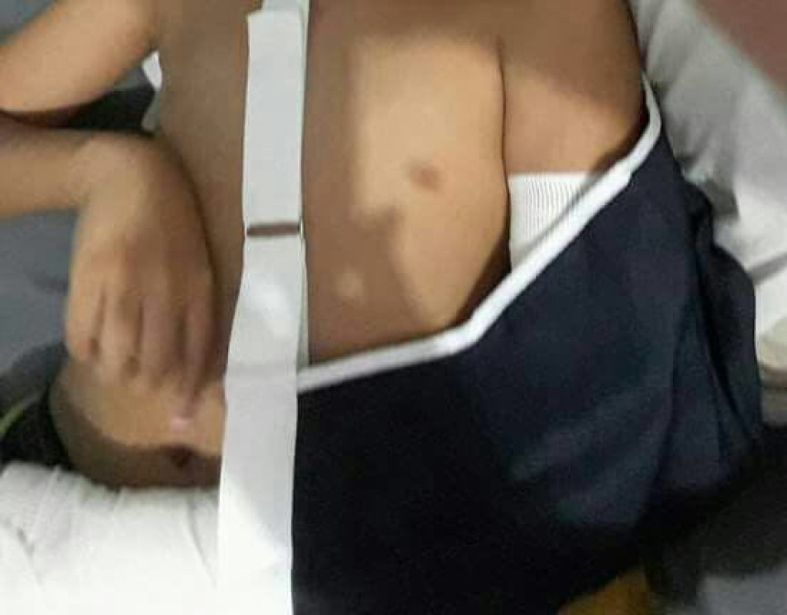 Compañeros de clase le fracturan brazo a alumno de escuela en Madero 