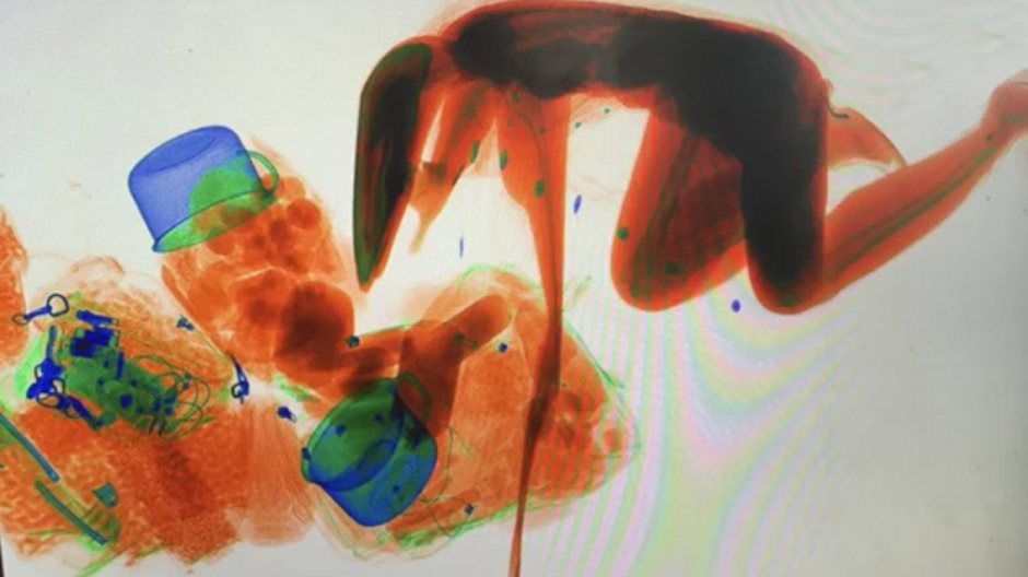 Mujer evita revisión y entra a máquina de rayos X