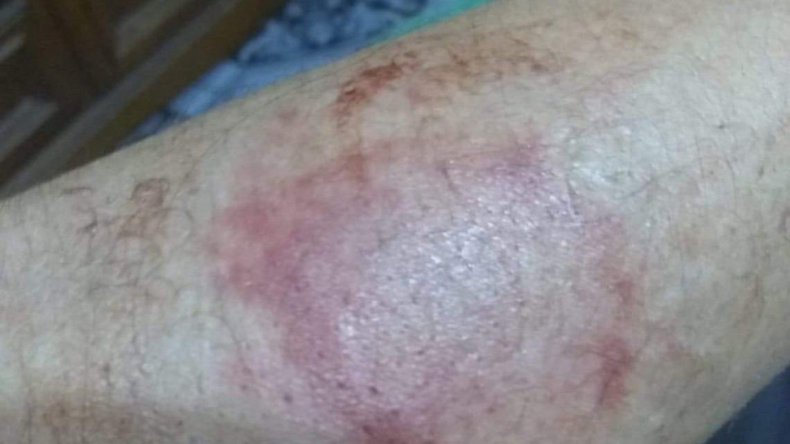 Golpean a defensora de los derechos humanos