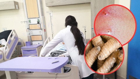 Honduras registra el primer caso de gusano barrenador en humanos