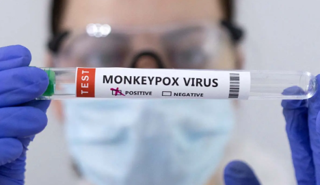 Brasil y España, confirman primeras muertes por Viruela del Mono, fuera de África