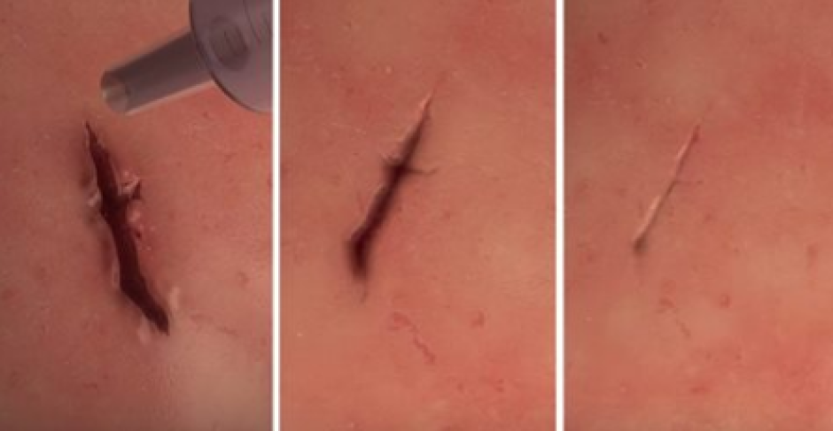 Con este pegamento, olvídate de las puntadas