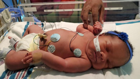 El sorprendente caso de la bebé nacida a las 9:11 p.m. el 11 de septiembre