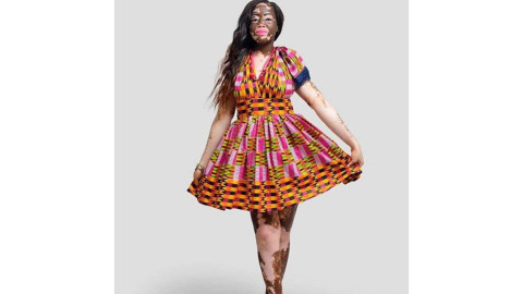 Honya Enam, una modelo que supero los estereotipos