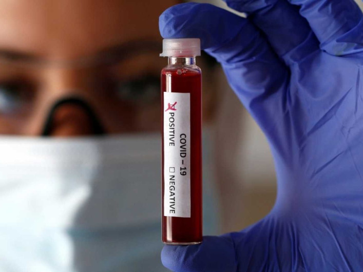 Confirman 10 nuevos casos positivos por covid-19 en el Condado de Cameron; suman 87