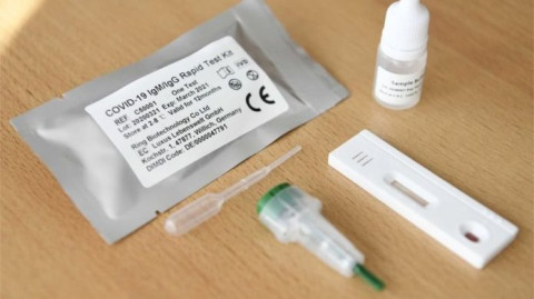 En México no se permite el uso de pruebas rápidas para detectar COVID-19