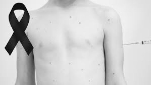 Mueren dos menores de edad por sarampión en Chihuahua