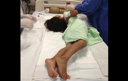 Registran primer caso de tétanos en 30 años