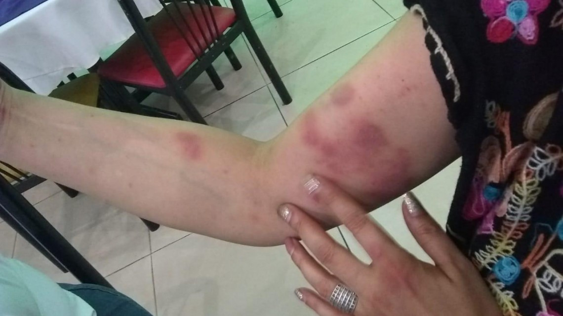 Golpean a defensora de los derechos humanos