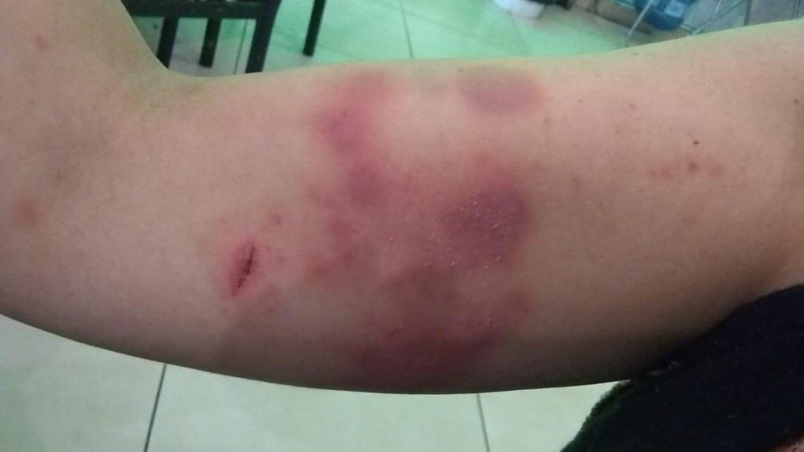 Golpean a defensora de los derechos humanos