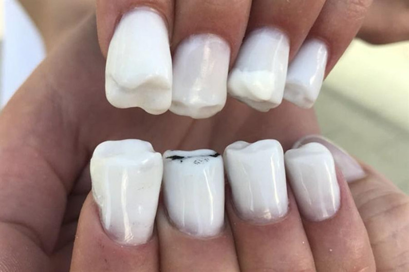 Te presentamos las “uñas muela”