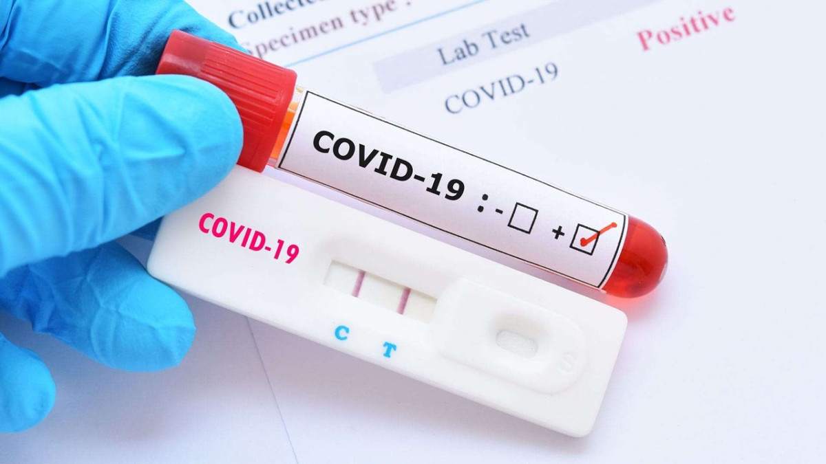 Registra Uruguay 5 mil 649 casos de COVID-19 en la primera semana de enero