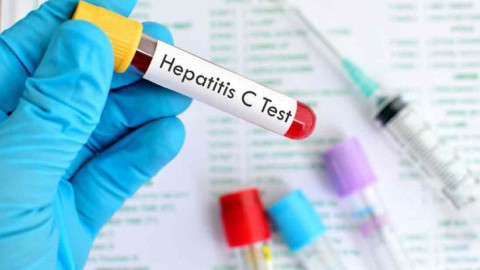 OMS precalifica el primer autotest de diagnóstico para la hepatitis C