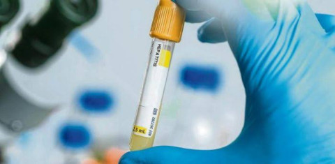 Alerta la OMS que la nueva hepatitis es un tema "muy urgente"