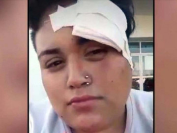 Pandilla golpea brutalmente a joven lesbiana