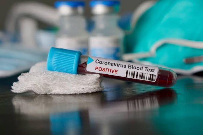 Estados Unidos suma 823,000 casos confirmados y 44,845 muertes por COVID-19
