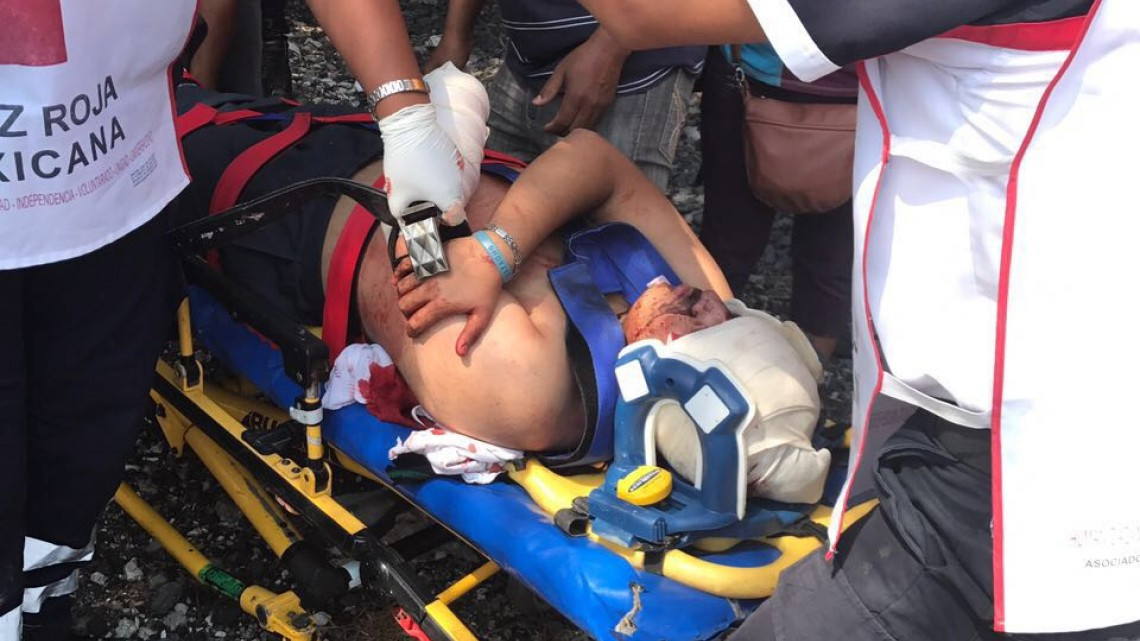 Tren le mutila brazo izquierdo a estudiante de Conalep